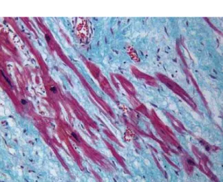 Table 1    Reaction of cells present in the myocardial scar to used markers