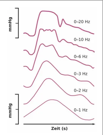 Abbildung 1: Schrittweise Zerlegung der Pulswelle in ihre Frequenzanteile. Erstellt nach Daten aus [1].