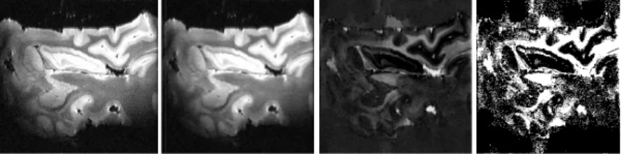 Figure  4.  Image  binarization  usi after mean filtering (c) Image ob means clustering