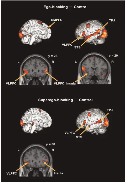 Figure 2. Brain regions showing greater activation in the ego-blocking condition than the control condition and in the superego- superego-blocking condition than the control condition