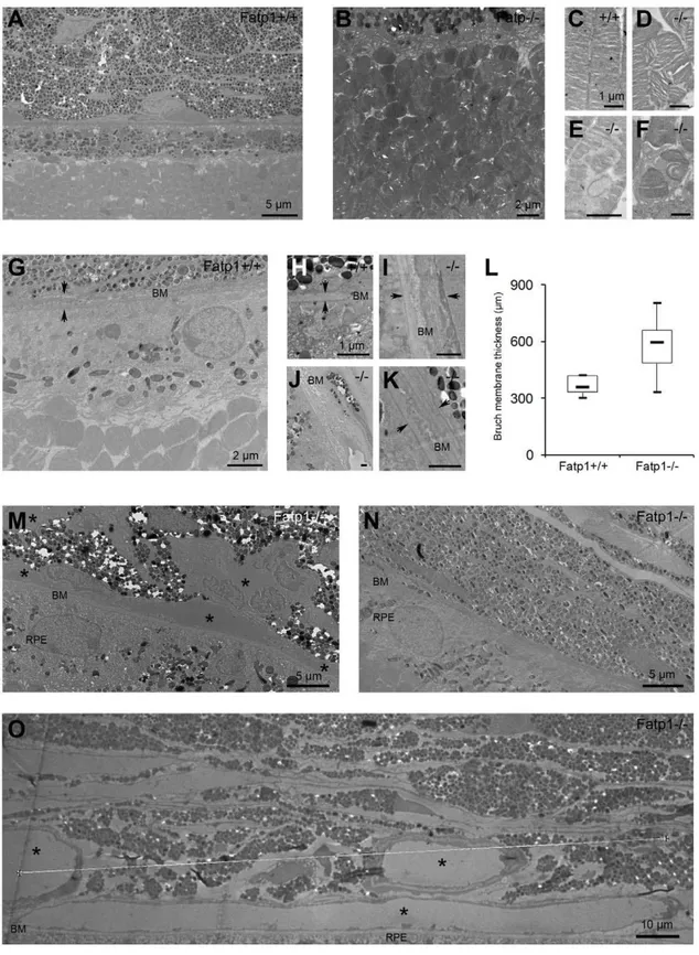 Figure 7. Ultrastructural aging of the Fatp1 2/2 retina. A: TEM at low magnification of a Fatp1 +/+ retina