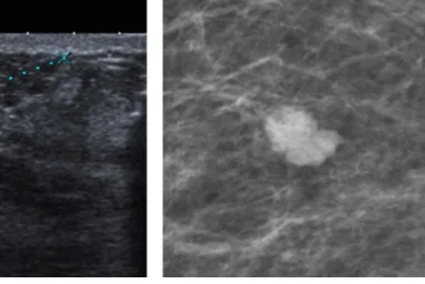 Figure 1 – Haemangioma. 