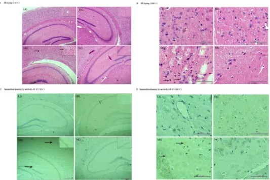 Fig 5. Immunofluorescence staining with rabbit anti-Aβ1 – 42 and HE dyeing of the temporal cortex and hippocampus of APP/PSN mice