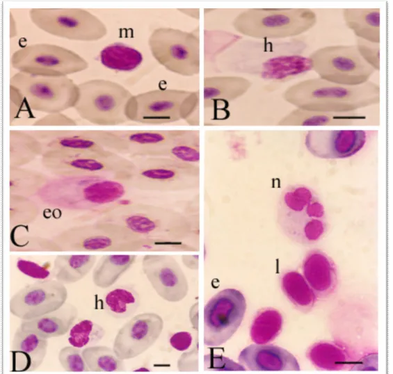 Figure 2.  Light  m icroscopic m icrographs of peripheral blood.  ( A)  e,  ery t hrocy t e;   