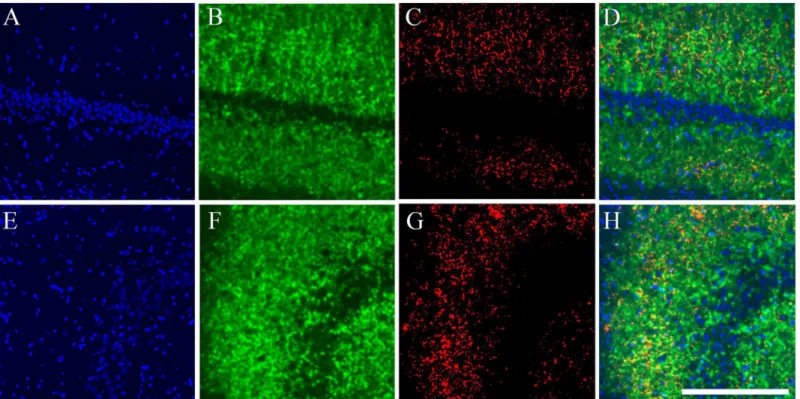 Fig 7. Synaptophysin/Map2 Split Channel and Higher Magnification Images. Immonostained tissue for synaptophysin and Map2 imaged with the Zeiss ApoTome ™ system, equipped with a motorized stage which allows the acquisition of montage or mosaic images with t