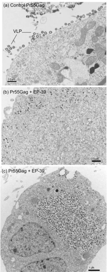 Figure 8. Electron microscopy of Pr55Gag-expressing cells.