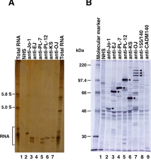 Figure 2. Representative immunoprecipitation assay for RNA with anti-aminoacyl-tRNA synthetase (anti-ARS) sera