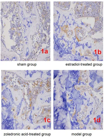 Fig 1. Expression of β-catenin in each group (IHC, ×400). (1a-1d) Representatives of β-catenin staining in bone tissue cells in sham/normal group (1a), ovariectomized osteoporosis associated with estradiol-treated group (1b), ovariectomized osteoporosis as