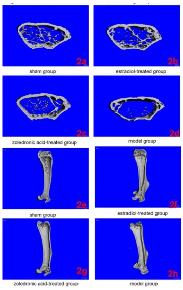 Fig 2. Micro-CT of left femurs in the four groups. (2a-2d) Three-dimensional images reconstructed from micro-CT analysis on the cortical and trabecular bone microarchitecture of distal femoral metaphysis (cross section) in four groups