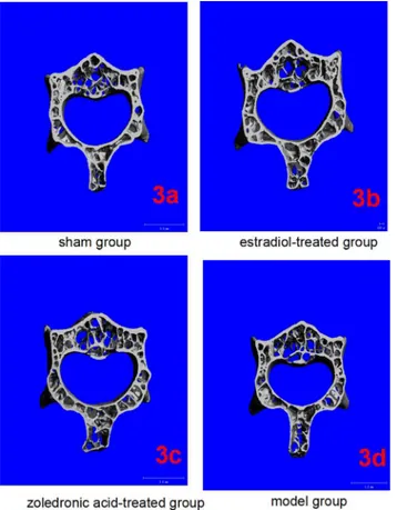 Fig 3. Micro-CT of lumbar vertebrae in the four groups. (3a-3d) Three-dimensional images reconstructed from micro-CT analysis on the cortical and trabecular bone microarchitecture of 3rd lumbar (cross section) in four groups.