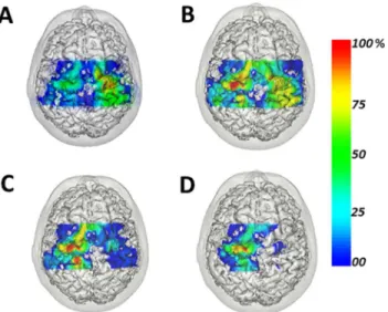 Fig 4. Motor-evoked potential (MEP) amplitudes recorded at each stimulated scalp point and projected on the 3-dimensional brain image of a representative patient (P6)–top view