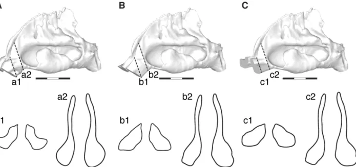 Fig 1. Virtual nasal topology models. (A) Normal, (B) no-valve, and (C) horizontal models