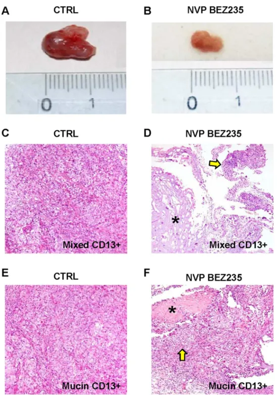 Fig 7. Effect of NVP-BEZ235 on subcutaneous human tumor xenografts. In control mice (CTRL), the tumor volume of subcutaneous xenografts increased during four weeks of observation (A) while in mice treated for 2 weeks with NVP-BEZ235 (B) it remains almost s