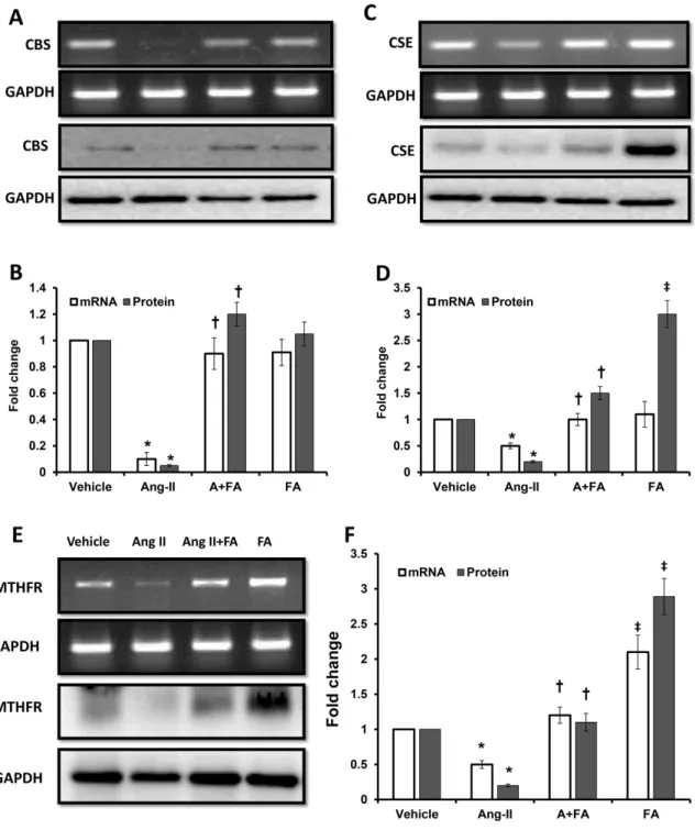 Figure 5. mRNA and protein expression of CBS/CSE and MTHFR is decreased in Ang II induced hypertension Effect of vehicle, Ang II and FA on the mRNA and protein expression of CBS (A); CSE (C) and MTHFR (E) as determined by semiquantitative RT-PCR and Wester