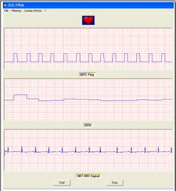 Fig. 5.  The Design test via LPT1of a PC 