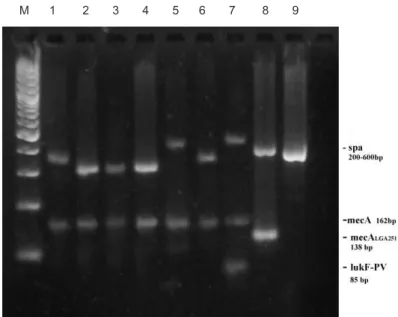 Figure 3. Multiplex PCR (spa, mecA, pvl, mecA LGA251 ). M – molecular marker 50-1000bp, 1-5 – MRSA isolates,   6 – Positive control (MRSA ATCC 43300), 7 – Positive control (PVL pozitivan S.aureus), 8 – Positive control   (S