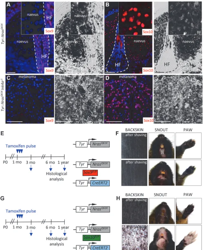 Figure 3. Mouse giant congenital naevi and melanoma reveal no expression of Sox9. A-D, Immunostaining for Sox9 (A, C) and Sox10 (B, D) in the skin sections of Tyr::Nras Q61K and Tyr::Nras Q61K INK4a −/− mice