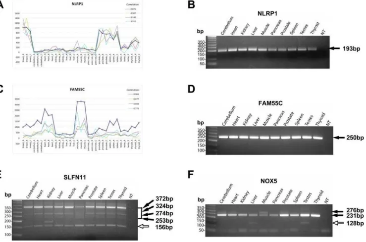 Figure 1. Examples of ‘‘Correlated’’ Exons analyzed by Exon Array analysis, semi-quantitative RT-PCR and sequencing