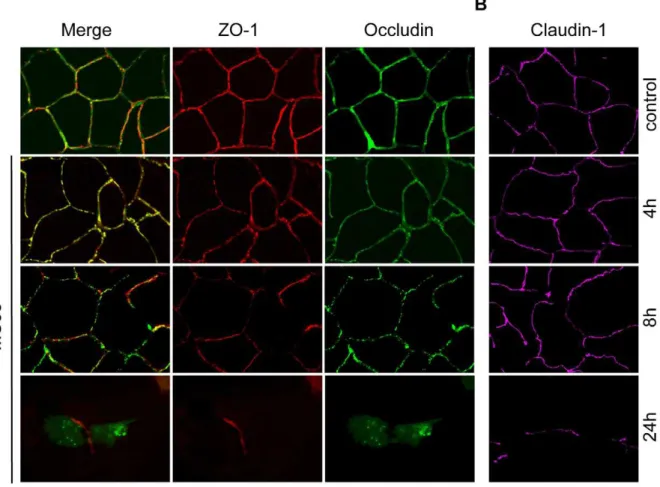 Figure 2. Effect of N. meningitidis on the tight junction proteins occludin, ZO-1 and claudin-1