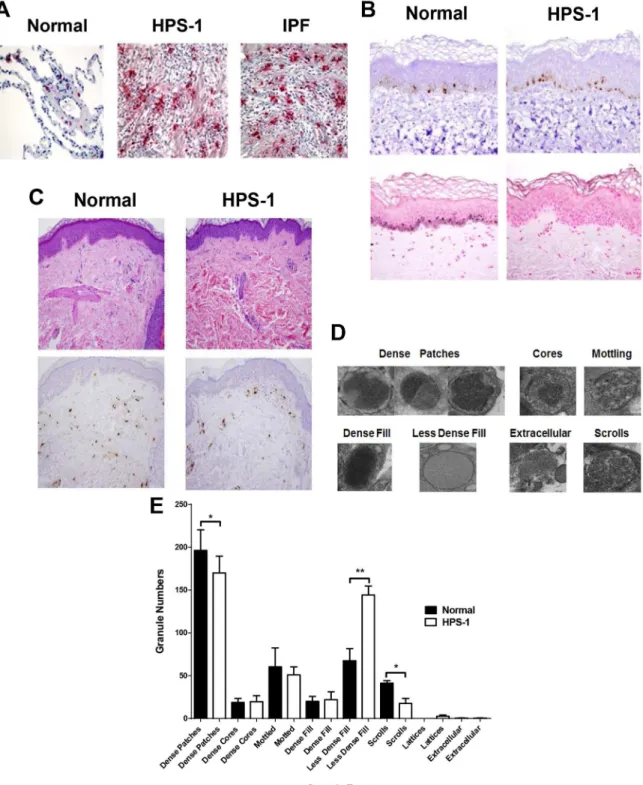 Fig 1. Pulmonary mast cells localize to fibrotic regions of the lung parenchyma in HPS-1 pulmonary fibrosis.