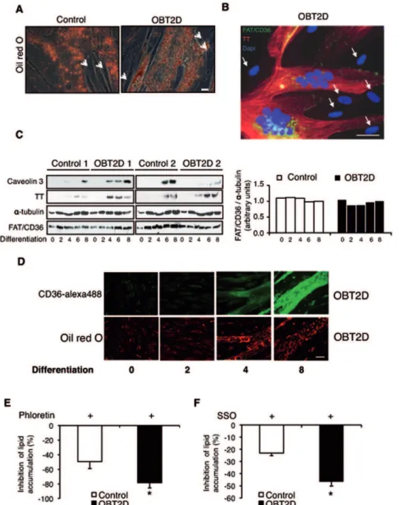 Figure 2. Increased membrane localization of FAT/CD36 during differentiation is responsible for increased lipid accumulation in OBT2D myotubes
