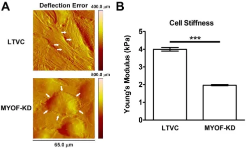Figure 6. Average traction stress and contractility decreases when MYOF is depleted from MDA-MB-231 cells