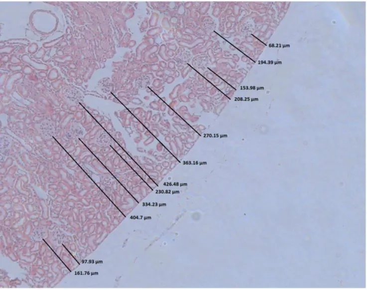 Figure 1. Determination of the depth of glomeruli from the kidney surface of a mouse. The length of the shortest vertical line from the kidney surface to the closest aspect of the glomerulus was determined.