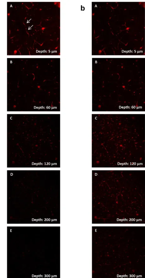 Figure 5. z-stack of the postcentral gyrus of the mouse brain in vivo. (A)–(E) show blood vessels (arrows), stained by Texas Red 70 kDa Dextran in 5, 60, 120, 200 and 300 mm underneath the brain surface
