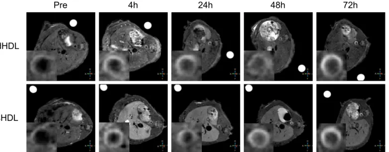 Fig 3. Targeted in vivo imaging of macrophages in aortic atherosclerotic lesions. (A) Representative axial T 1 -weighted images of apo E knockout (KO) mice, collected before (Pre) and 4 h, 24 h, 48 h and 72 h after contrast agent administration