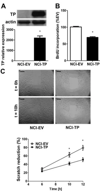 Figure 3. Effect of TP overexpression on proliferation and migration of NCI-H292 cells in vitro 