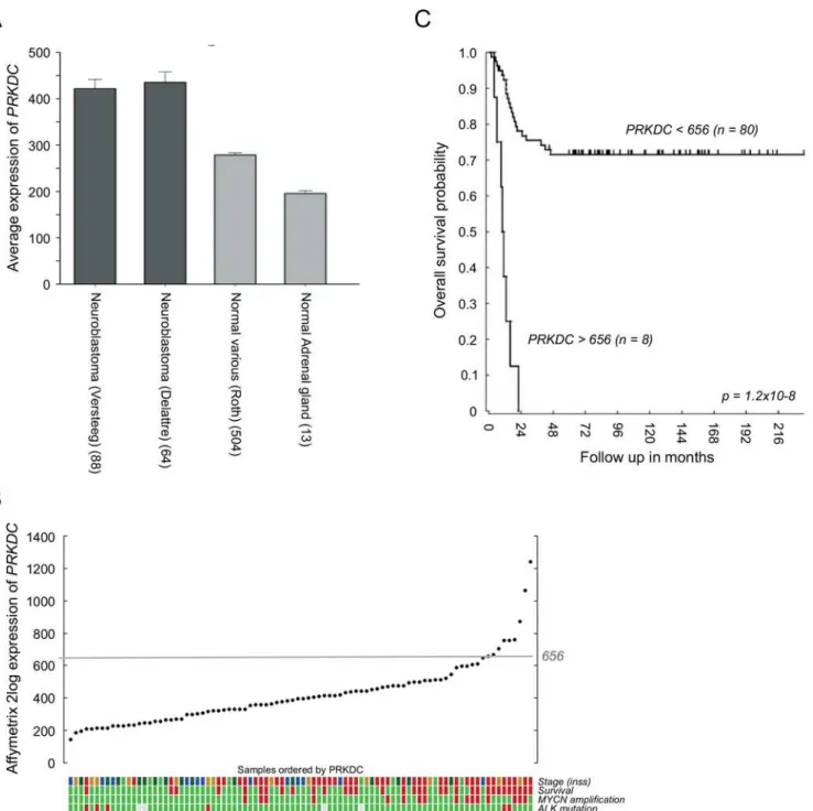 Fig 1. Enhanced PRKDC expression in neuroblastoma patients correlates with a poor prognosis