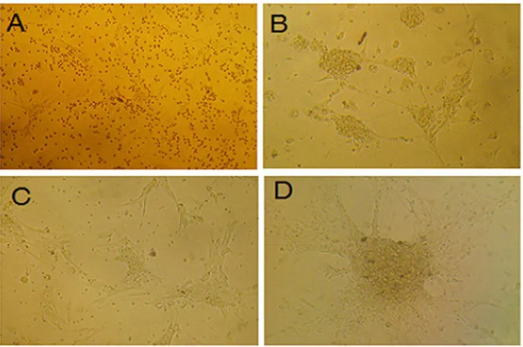 Figure 1. Hippocampal neurons (x100). (A) Cultured at 24 hours, part of the cells stretched out neurites with different thickness, and the somas were cone or polygon-shape; (B) cultured at day 3, the neurons increased and the neurites connected into a netw