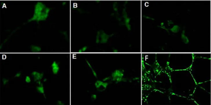 Figure 2. Expression of NT-4. NT-4 expression in control group (Figure 2-A), model group (Figure 2-B), low concentration of GLS group (Figure 2-C), culture medium concentration of GLS group (Figure 2-D), high concentration of GLS group (Figure 2-E)