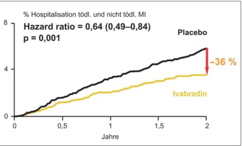 Abbildung 4:  Effekt von Ivabradin auf Myokardinfarkt (tödlich und nicht tödlich) (HF  ≥  70 Schläge/min)