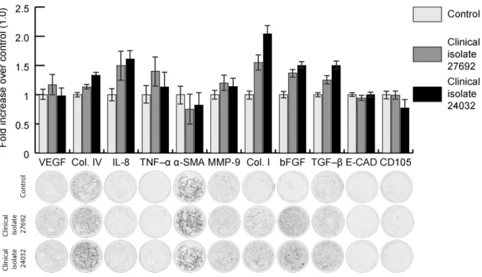 Fig 5. Changes in the expression of signaling molecules and proteins of cytoskeleton and extracellular matrix of hRPE cells grown in culture following inoculation with Chlamydia trachomatis (clinical isolates Nos