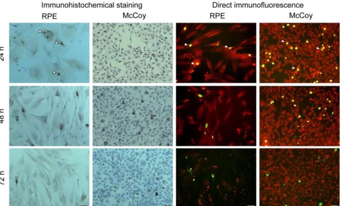 Fig 1. Immunohistochemistry and direct immunofluorescent staining of hRPE and McCoy cell cultures at different time-points postinoculation with Chlamydia trachomatis (clinical isolate No.24032)