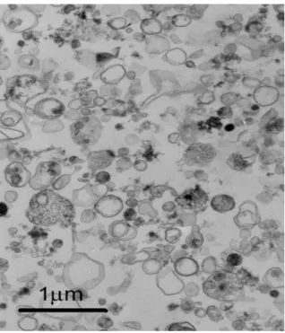 Fig. 4 Electron micrograph of the final membrane  pellet from B. oleae whole adults. 