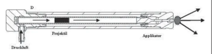 Abbildung 1: Schematische Darstellung einer ballistischen Stoßwellen- Stoßwellen-quelle