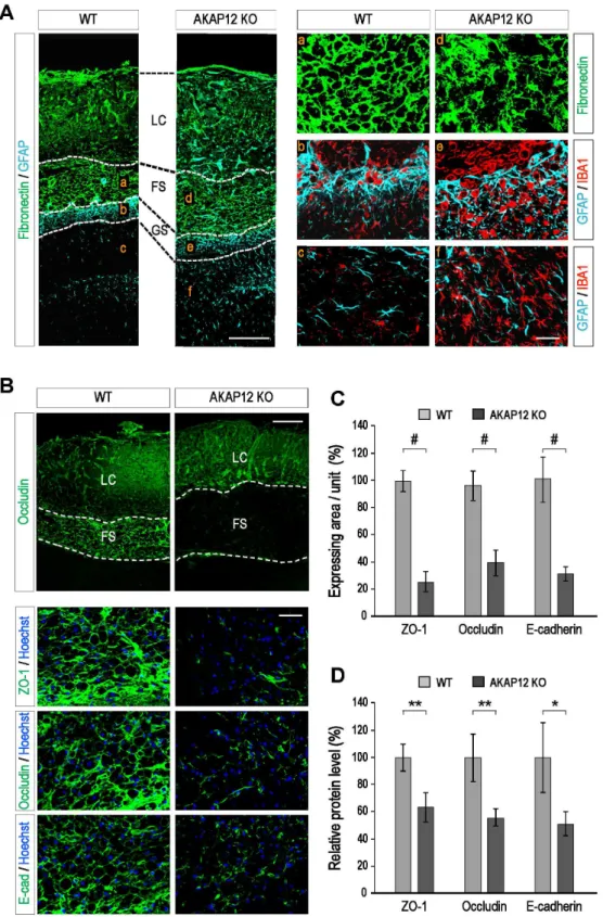 Figure 4. AKAP12 KO mice showed an impaired fibrotic scar structure with loss of junction complexes