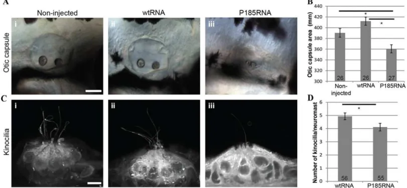 Fig 3. Over-expression of wtRNA and P185RNA in zebrafish embryos. (A) Otic capsule morphology in non-injected (i, n = 26), wtRNA-injected (ii, n = 26) and P185RNA-injected (iii, n = 27) embryos at 72 hpf