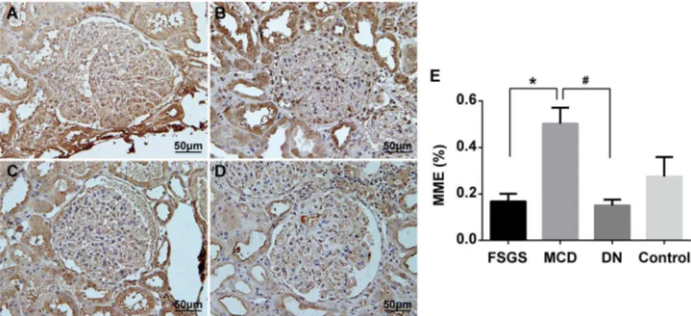 Fig 9. Immunohistochemical staining of MME in kidney biopsies from patients with FSGS, MCD and DN