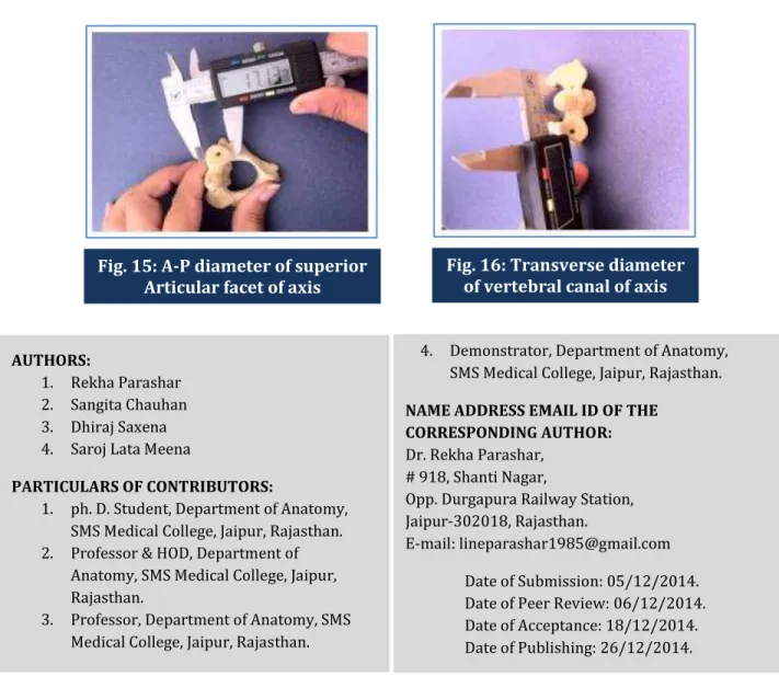 Fig. 15: A-P diameter of superior  Articular facet of axis