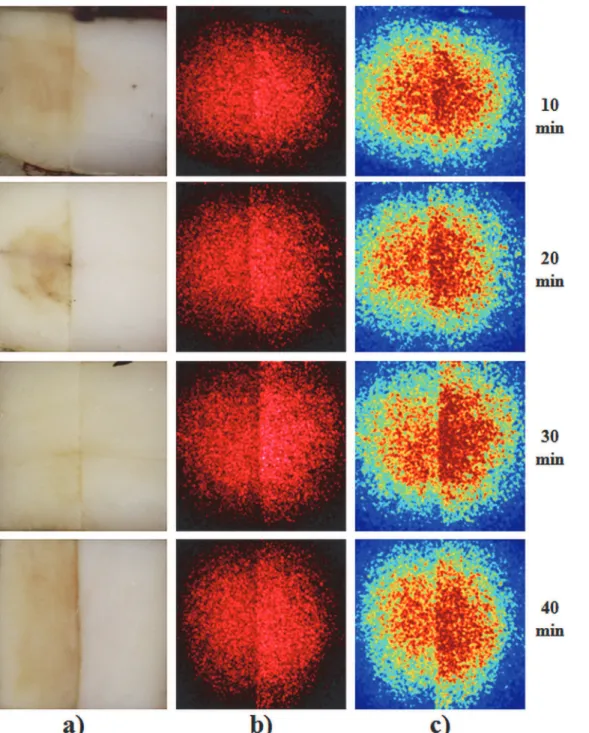 Fig 3. Sample; (a) white light image; (b) coherent light image; (c) false color image with averaged intensity.