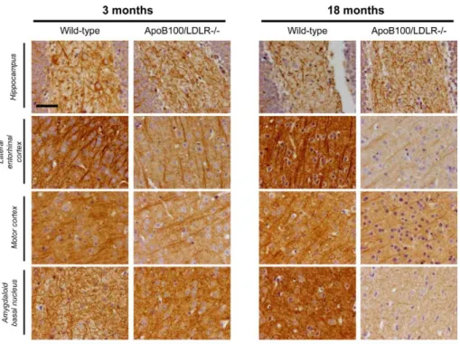 Figure 4. MAP2 staining in young and aged wild-type and transgenic mice. MAP2 staining of coronal sections (1.78 mm from the bregma) of the left (contralateral) hemisphere of a mouse brain from each of the age/genotype groups