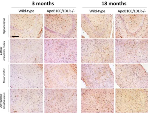 Figure 7. b-amyloidosis in the cerebral vessels of young and aged wild-type and transgenic mice