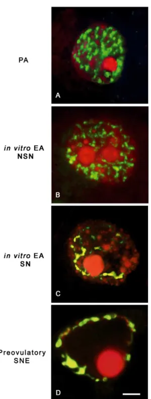 Figure 5. Dnmt3a nuclear distribution pattern during in vitro and in vivo oocyte growth
