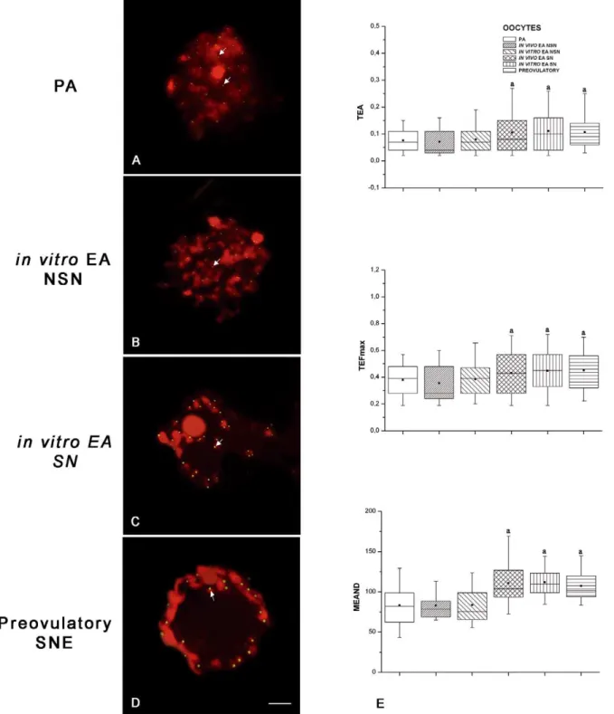 Figure 6. Germinal vesicle (GV) telomeres analyzed using the Q-FISH technique. Examples of paraffin-embedded follicle sections with telomeres visualized as bright green spots (FITC), while DNA was counterstained in red with PI