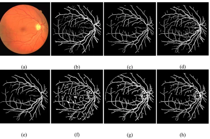 Fig 6. Visual inspection of different vessel segmentation methods using DRIVE database