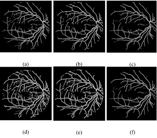Fig 8. Visual results of different thresholding techniques. (a) Proposed Otsu method. (b) TILT