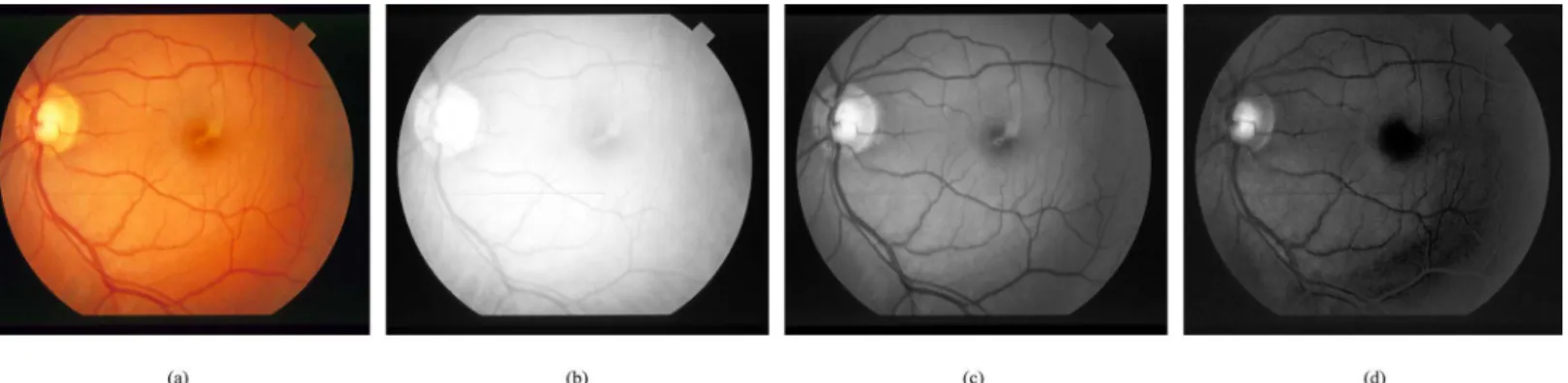 Fig 2. Retinal RGB image and its channels visual inspection. (a) RGB input image. (b) Red channel